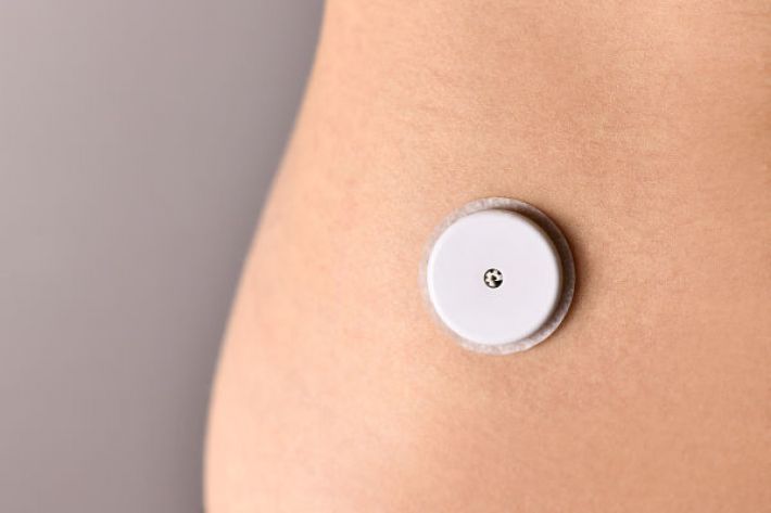 Continuous Glucose Monitoring and the Wellness Market