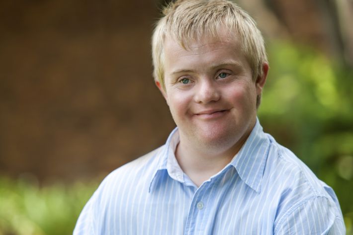 Hypothyroidism and Down's Syndrome