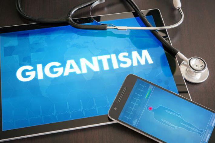 Gigantism - causes, symptoms and treatment