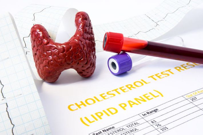 thyroid disease and cholesterol