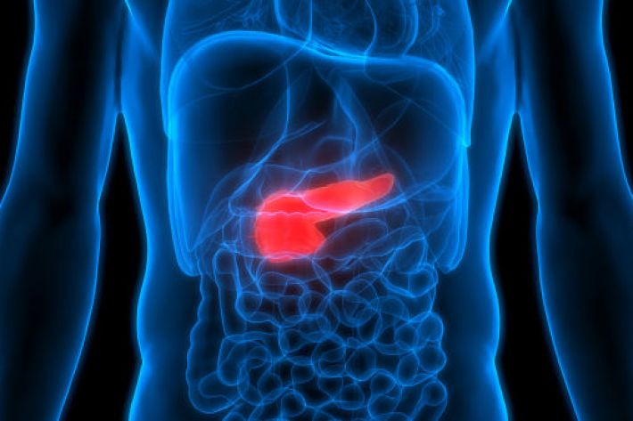 neuroendocrine tumour of the pancreas