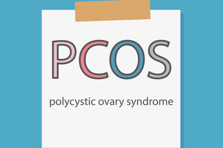Managing the risk of PCOS complications