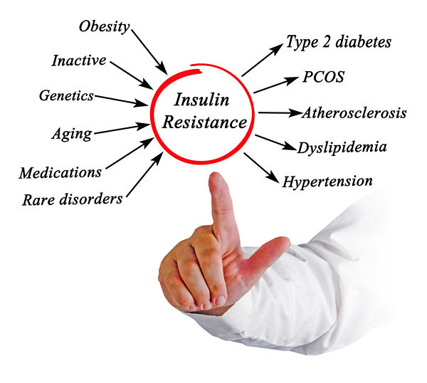 Is there a link between type 1 diabetes and PCOS