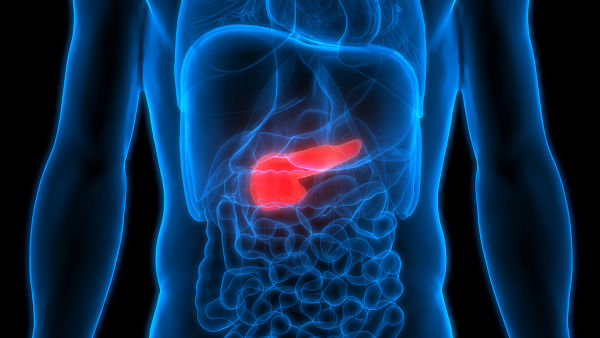 neuroendocrine tumour of the pancreas