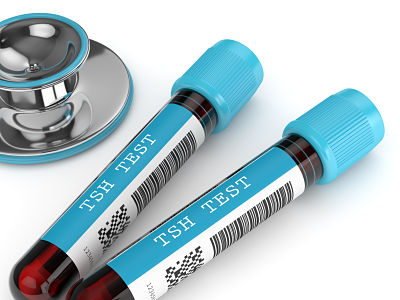 Understanding TSH test results
